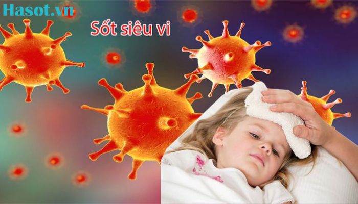 Sốt siêu vi ở trẻ em là tình trạng bé bị sốt do các loại virus tấn công vào cơ thể gây nên